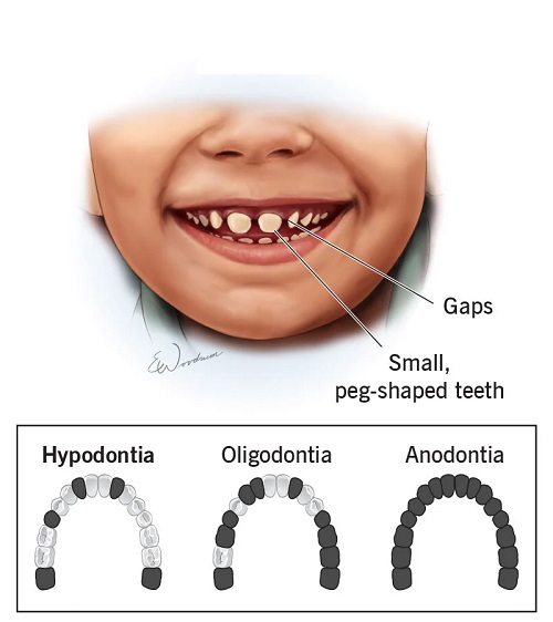 آیا خمیر دندان برای کودکان ضرر دارد ؟
