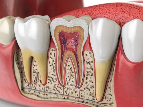 کانال های دندان در درمان ریشه و عصب کشی دندان