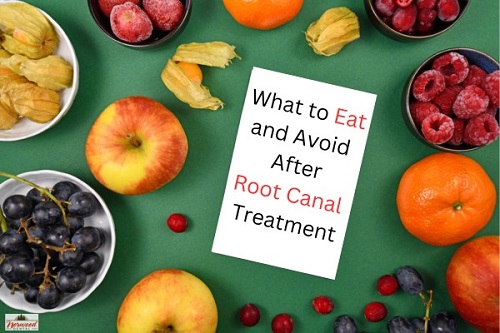 مواد غذایی مجاز بعد از درمان ریشه ؟ چند ساعت بعد از عصب کشی غذا بخوریم؟