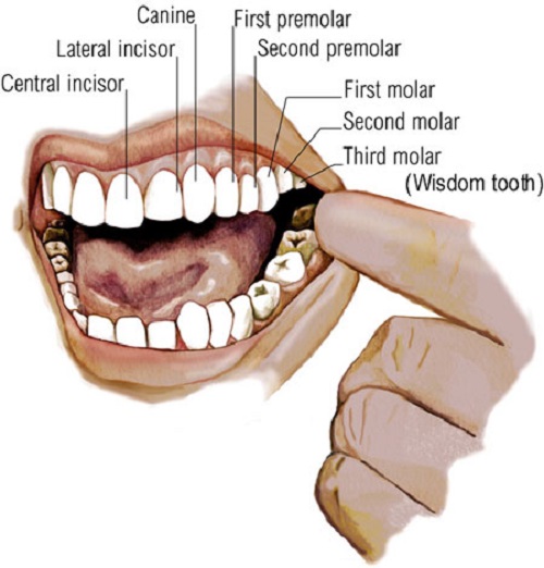 جراحی دندان عقل دندان 8 wisdom teeth 