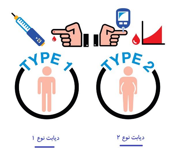دیابت نوع 1 و ایمپپلنت دندان دیابت نوع دو و ایمپلنت دندان