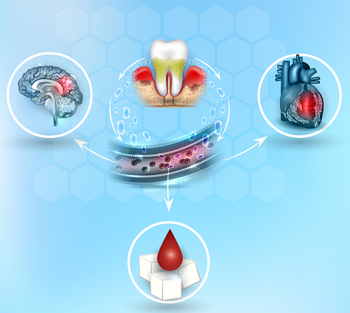  آیا افراد دیابتی بیشتر در معرض خطر هستند؟