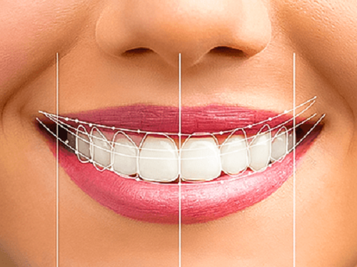 آیا طراحی دیجیتال لبخند، واقعی است یا فقط تبلیغاتی است؟