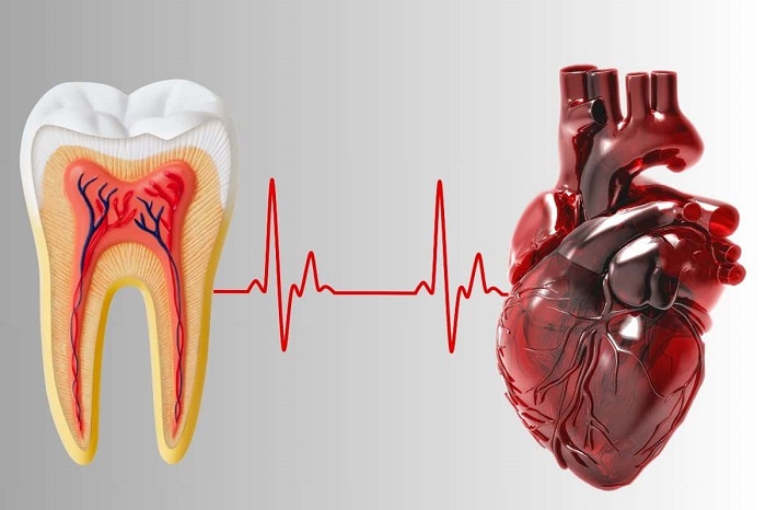 gum disease and heart attack and stroke