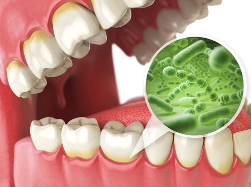 چگونه از میکروبیوم سالم دهان محافظت کنیم؟