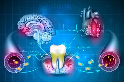  آیا خونریزی لثه طبیعی است؟